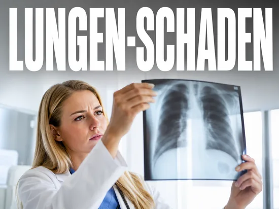 Blonde Aerztin betrachtet ein Lungen-Roentgenbild, Symbolbild Lungenschaeden durch Cannabis